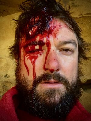 Hugh first aid scenario picture with fake blood